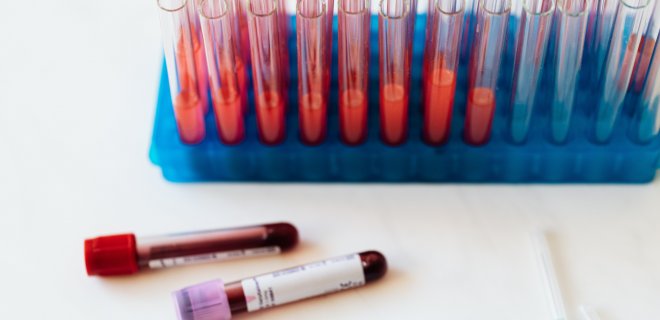 Asociatyvi / pexels.com nuotr.