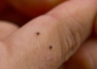 Rajone šiemet registruoti du Laimo ligos atvejai