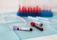 Labiausiai sergančiose savivaldybėse – intensyvūs patikrinimai dėl koronaviruso