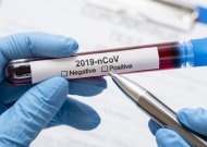 Per praėjusią parą patvirtinta dešimt koronavirusinės infekcijos atvejų