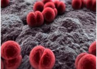 Šaltuoju metų laikotarpiu didesnė tikimybė susirgti meningokokine infekcija