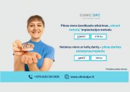 Dantų atkūrimas per parą – implantacijos laimėjimas, leidžiantis akimirksniu susigrąžinti šypseną